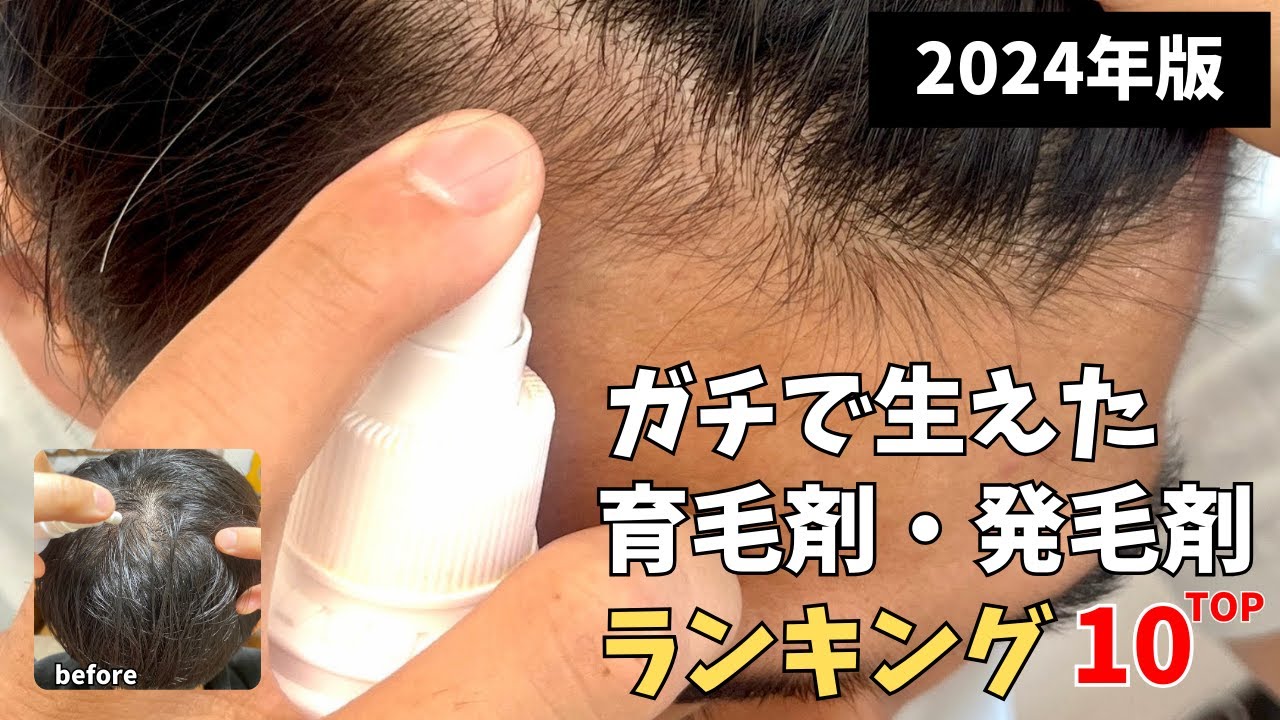 【2024年】ガチで髪の毛が生えるオススメの育毛剤・発毛剤ランキングTOP10【ガチ改訂版】 1