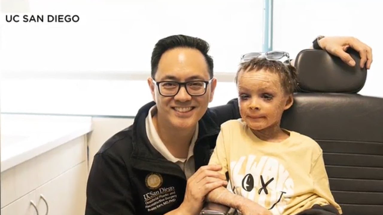 Doctor explains the eyelid surgery for Las Vegas boy with rare skin condition