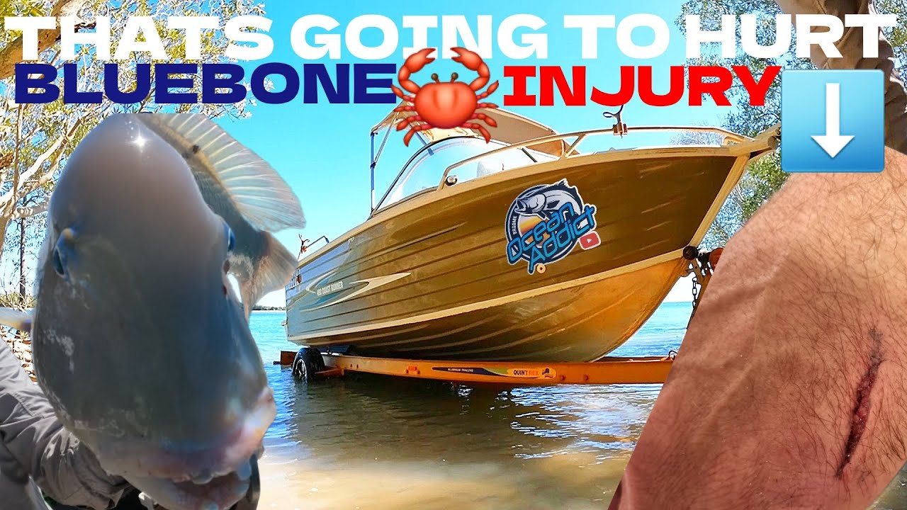 CRABBING INJURY(MAJOR) BLEEDING GET TO HIGH WATER MARK! BLUEBONE/TUSKFISH.