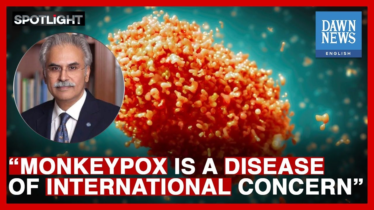 What Is Monkeypox? | Dr Zafar Mirza | Spotlight | Dawn News English