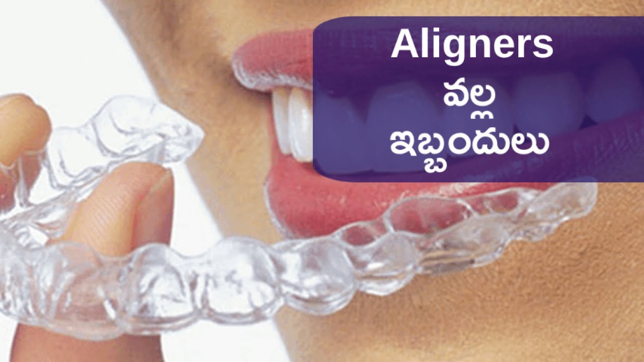 ALIGNERS | drawbacks | Telugu