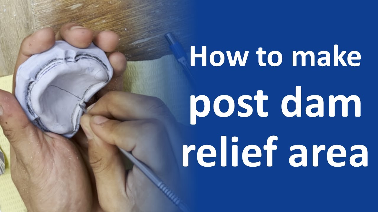 How to preparation post dam and relief area with tin foil
