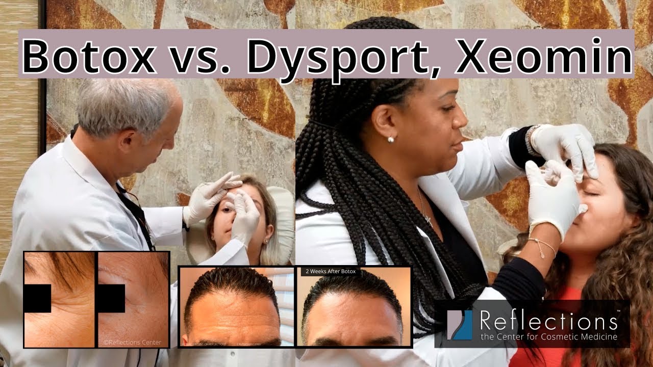 Botox vs. Dysport, Xeomin, MyoBloc [Which One is Right for You?]