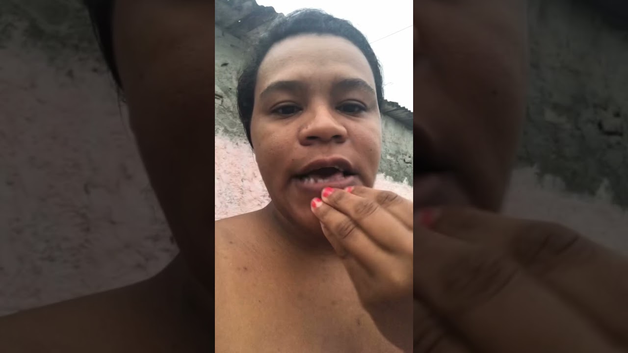 Cabe&ccedil;a pegando fogo #dornacabe&ccedil;a #maesolo