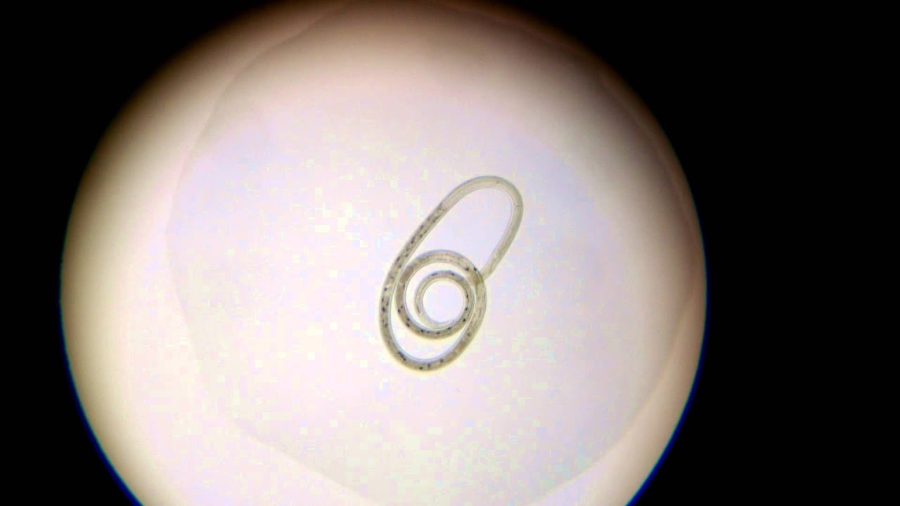 Unidentified worm #2