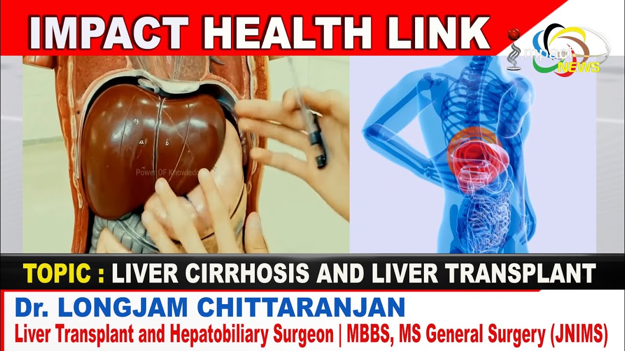 LIVER CIRRHOSIS AND LIVER TRANSPLANT | Dr. Longjam Chittaranjan on IMPACT HEALTH LINK 28 JAN 2023