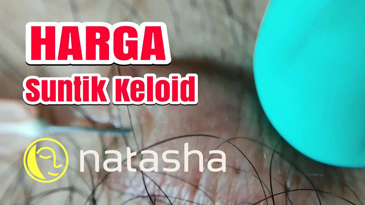 Harga Injeksi Keloid | Natasha Skincare Clinic Sidoarjo