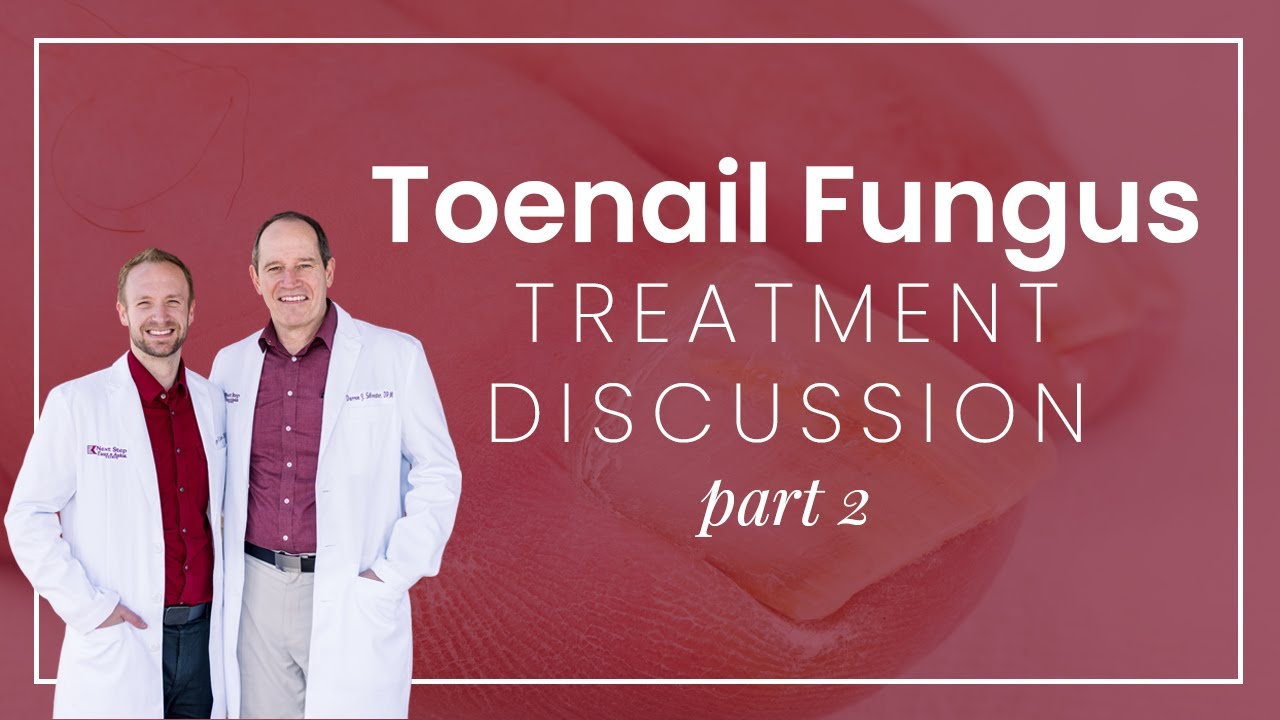 How Do You Treat Toenail Fungus? Part 2