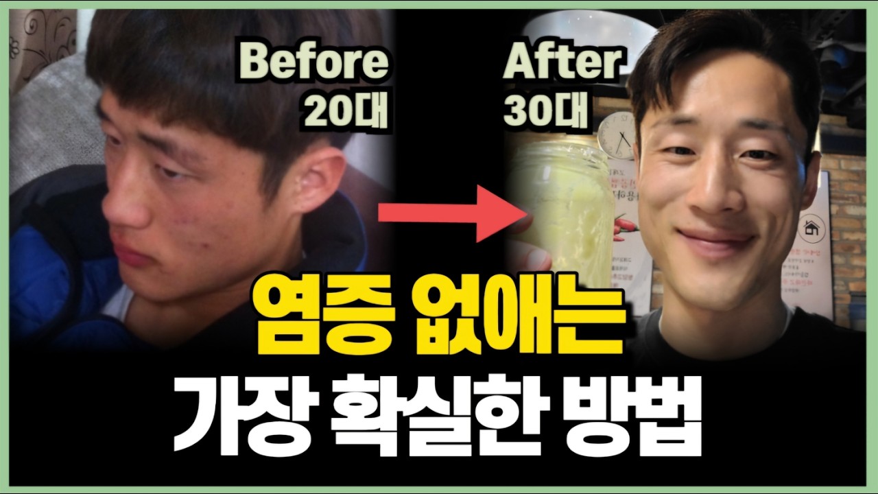 만성 염증 잡아내는 7가지 습관 