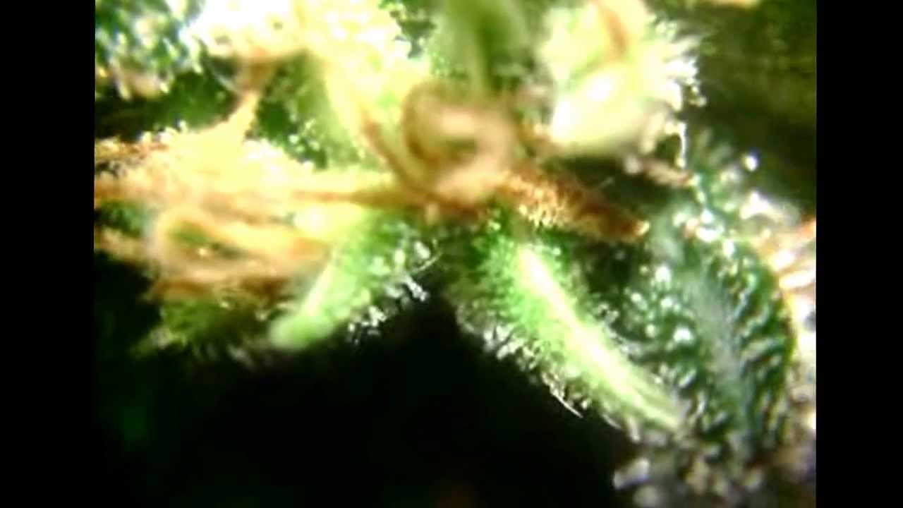 Trichome view thru cellphone microscope