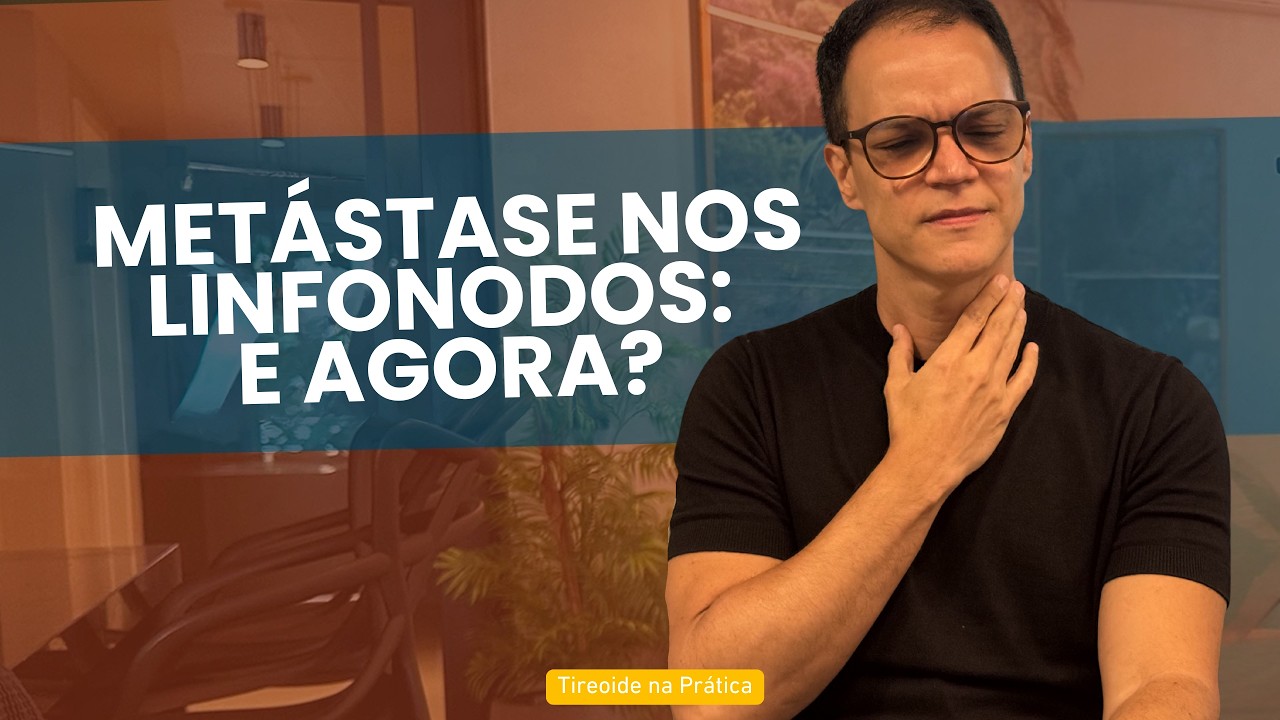 Câncer de Tireoide nos Linfonodos do Pescoço: É Grave? O Que Você Precisa Saber