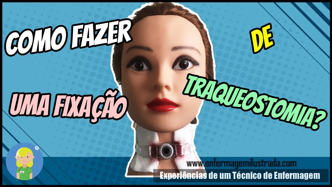 Como fazer Fixação de Traqueostomia