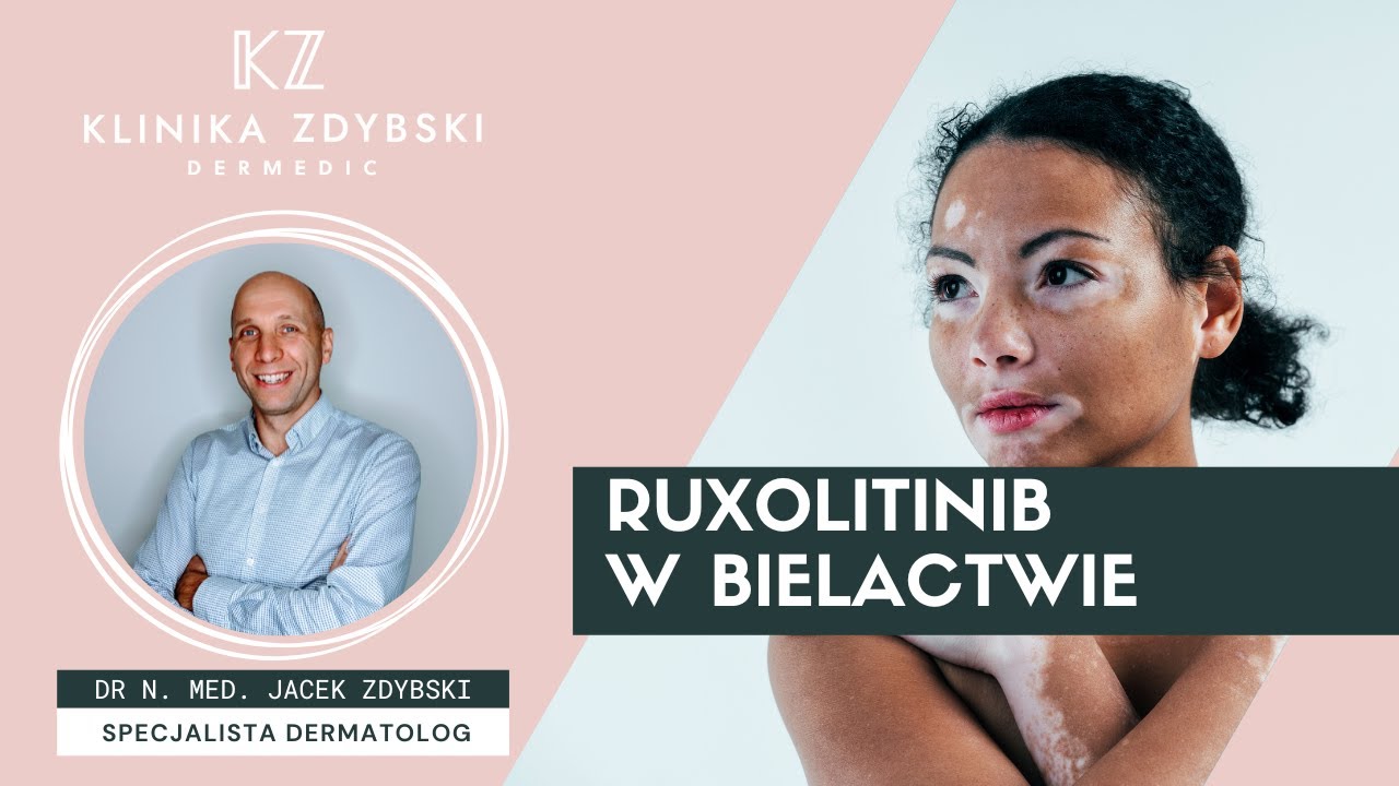 Dermatolog mówi o: Ruxolitinib w bielactwie