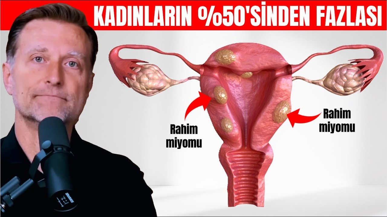 Kadınların %50'sinden Fazlası Bunu Yaşıyor! | Dr. Berg Türkçe