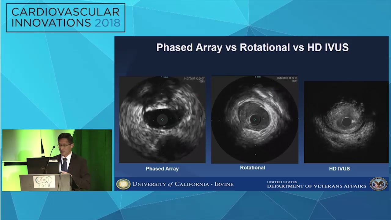CVI2018 Session: Innovation in coronary imaging - Arnold Seto, MD