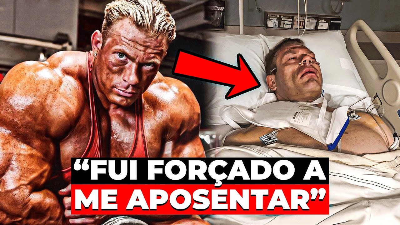 O que Aconteceu com Dennis Wolf?!