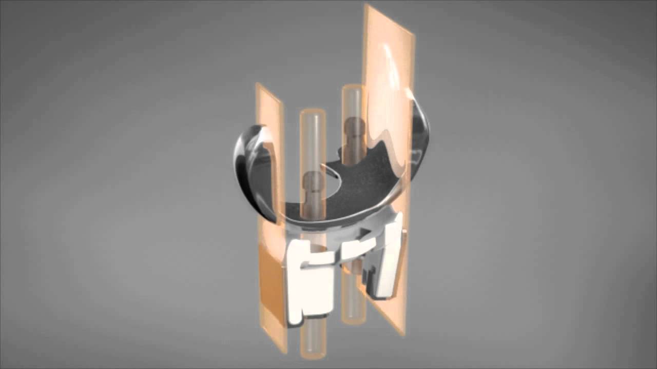 iDuo&reg; G2 iFit&reg; Technology Animation