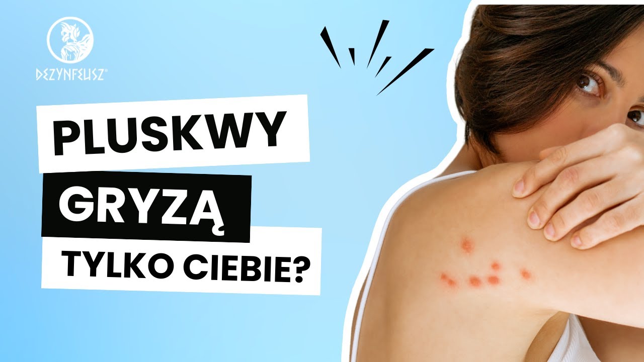 Ugryzienia pluskwy, one wybierają swoją ofiarę. Sprawdź, czy jesteś na liście!