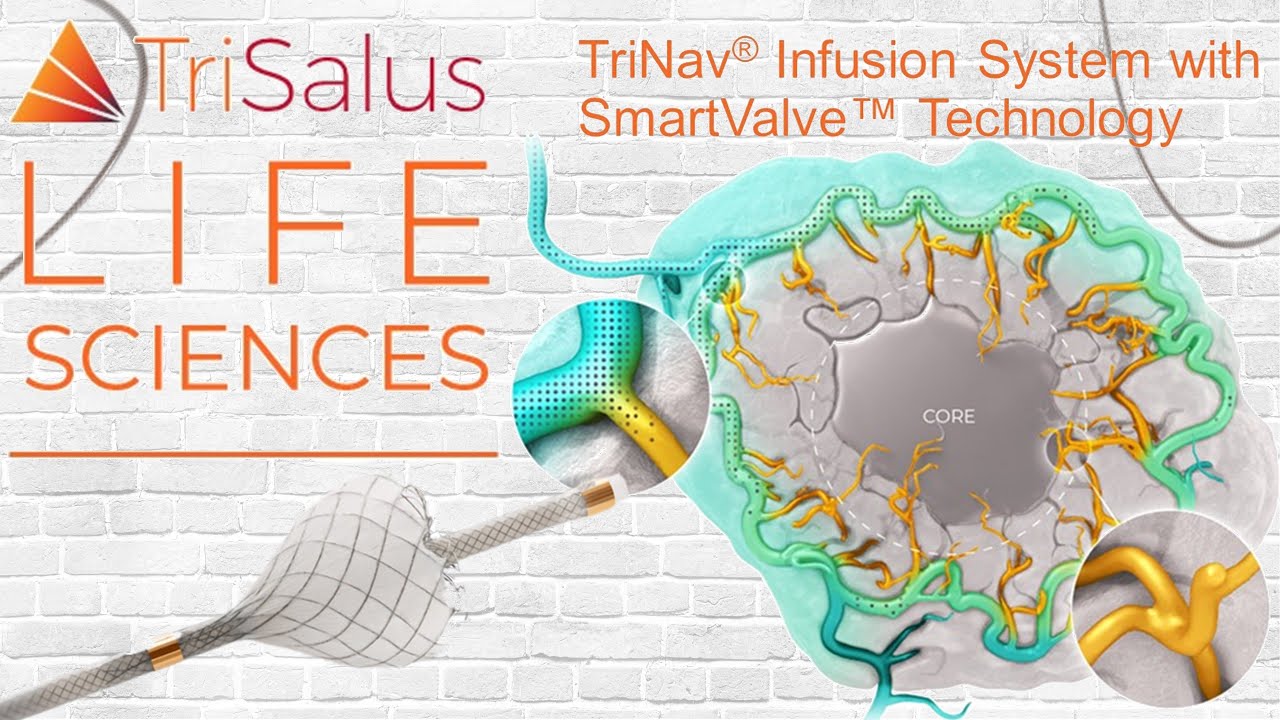 TriNav Infusion System | Smart Valve Technology