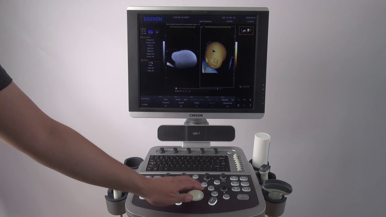 CHISON QBit 4D operation video