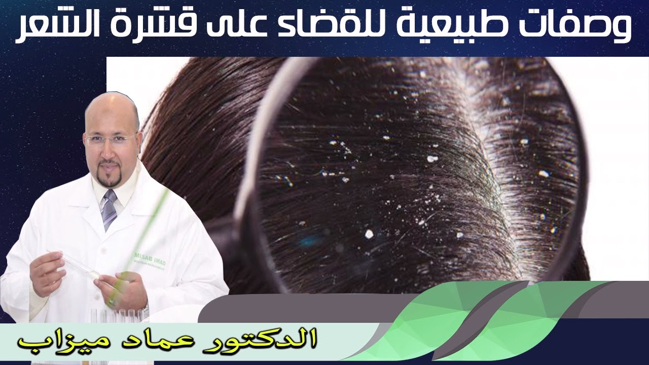 وصفات طبيعية للقضاء على قشرة الشعر الدكتور عماد ميزاب