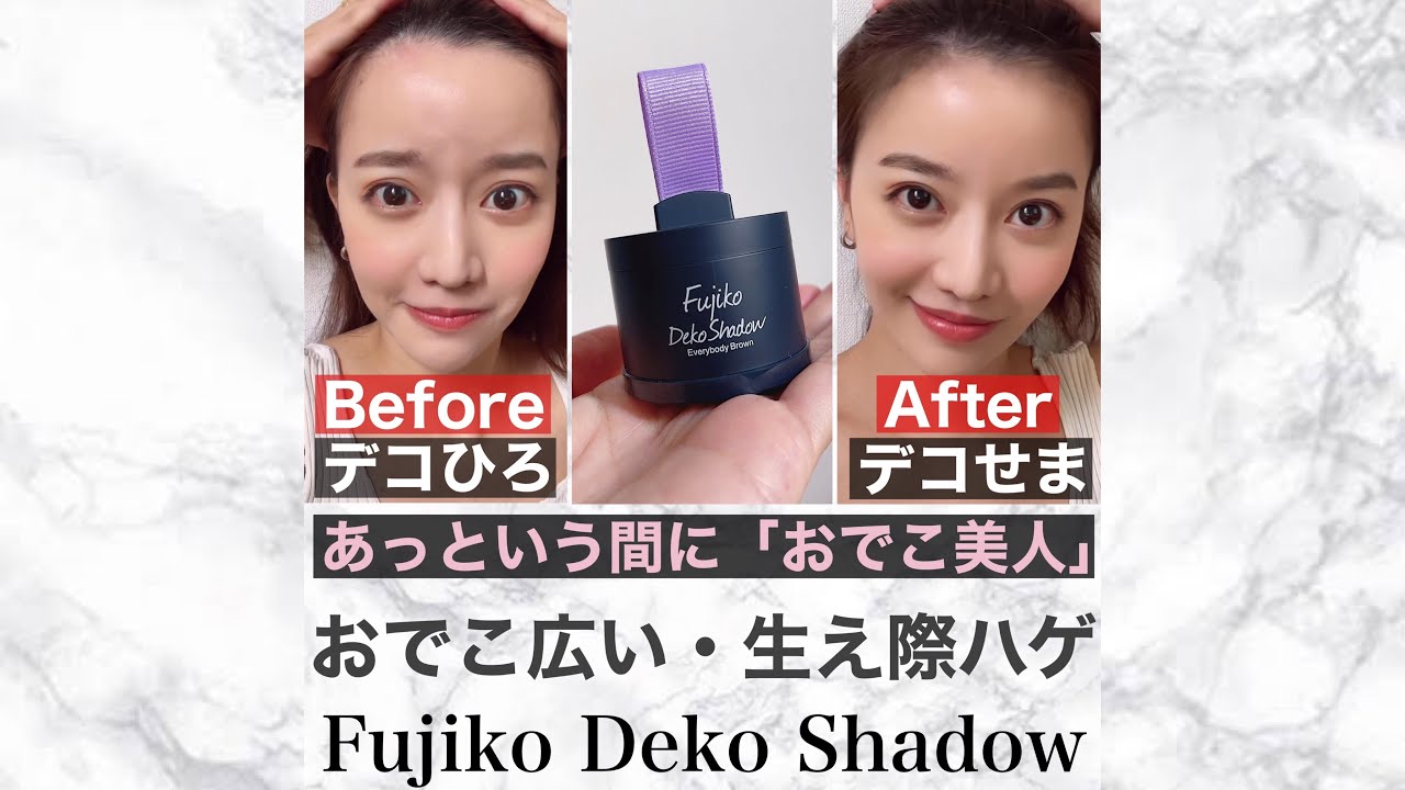 おでこハゲが、一瞬で解決！！生え際もフサフサ感でる。