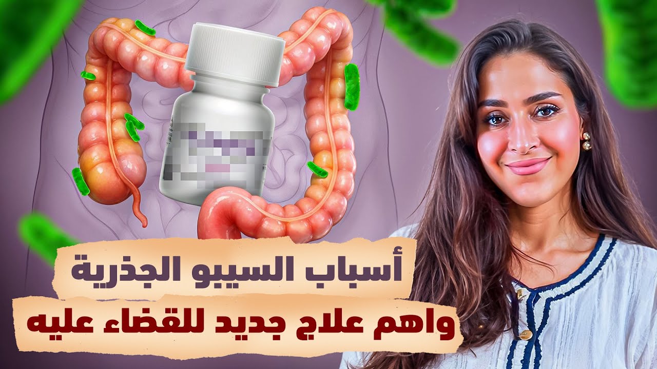 أسباب السيبو الجذريه واحدث علاج للقضاء عليه | د.فجر الجميري