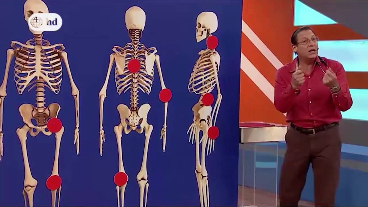 DR.TV - Síntomas de que debo ir al reumatólogo