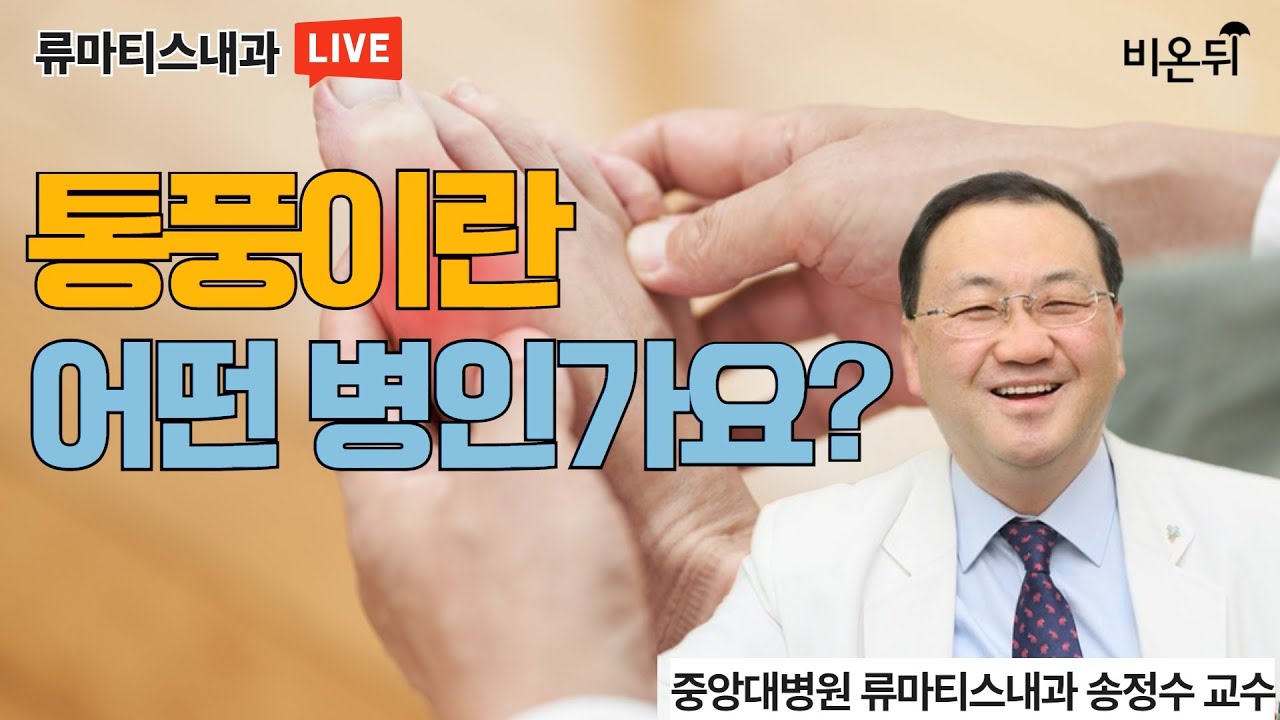 통풍이란 어떤 병인가요?(중앙대병원 류마티스내과 송정수)
