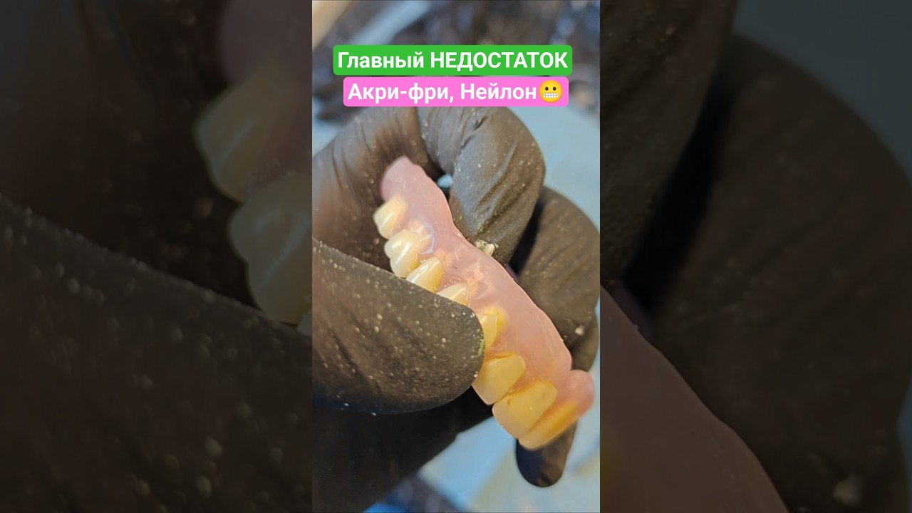 Желтеют зубы в Акри-Фри🙄 #безнёбасъёмныепротезы #съёмныепротезы #зубныепротезы #протезирование