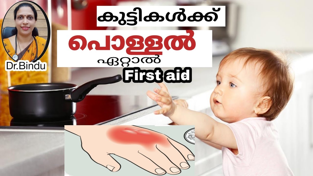 Burns in children first aid/കുട്ടികൾക്ക് പൊള്ളൽ ഏറ്റാൽ ചെയ്യേണ്ടത്/parenting tips