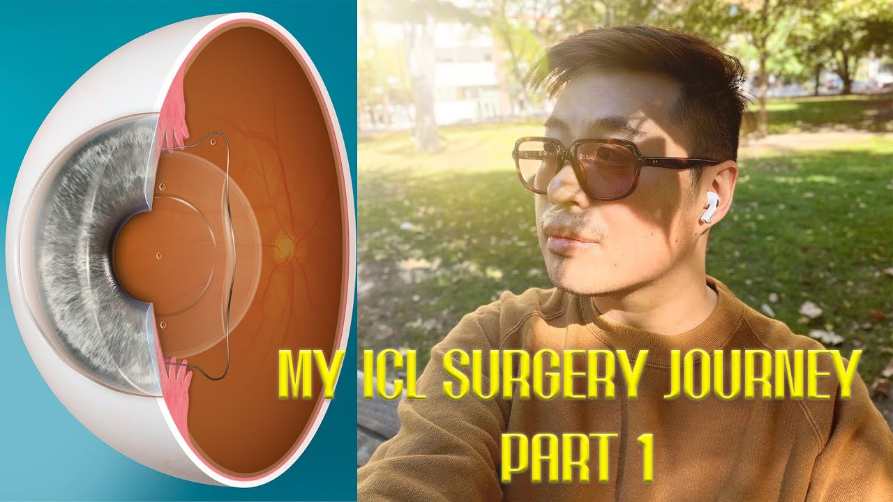 Why I’m Getting ICL Surgery 👁️ | My Vision Journey (Part 1)