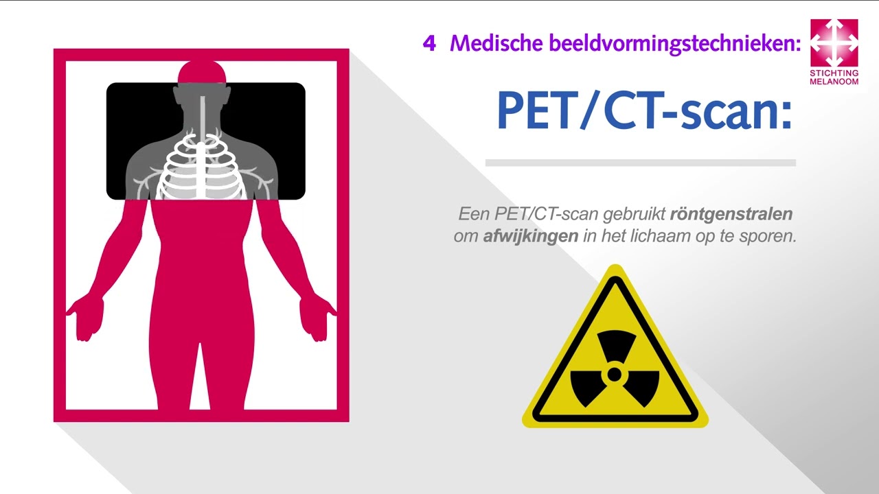 Diagnose stadium 3 melanoom deel 2