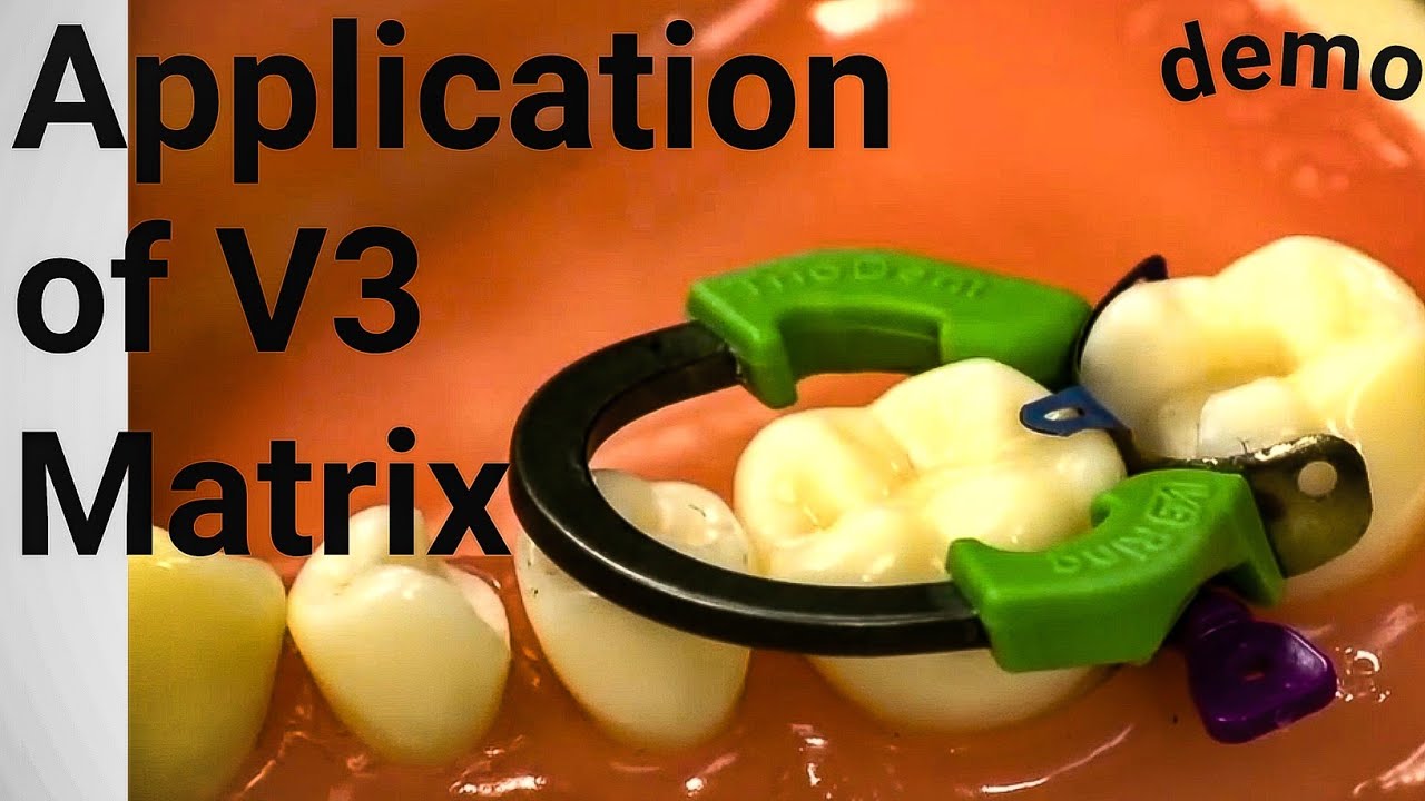 Demonstration of v3 matrix system ftom A to Z #matrix system 