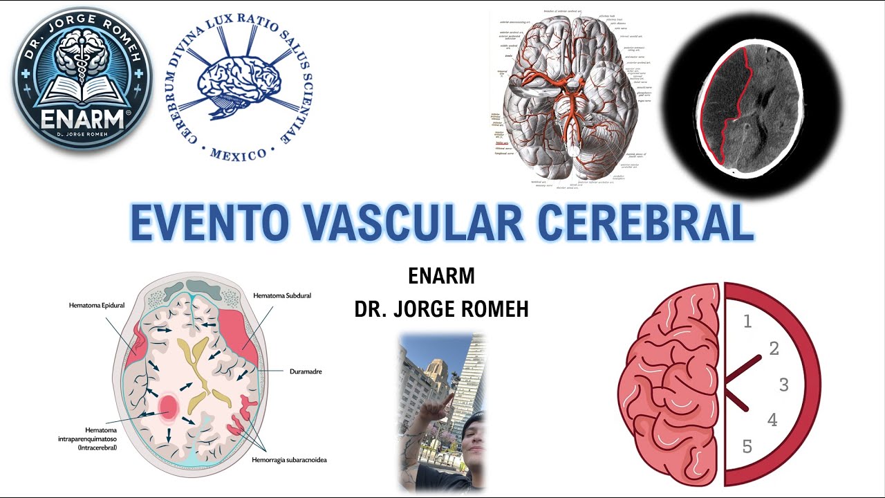 EVENTO VASCULAR CEREBRAL - PODCAST - AANS CHIAPAS