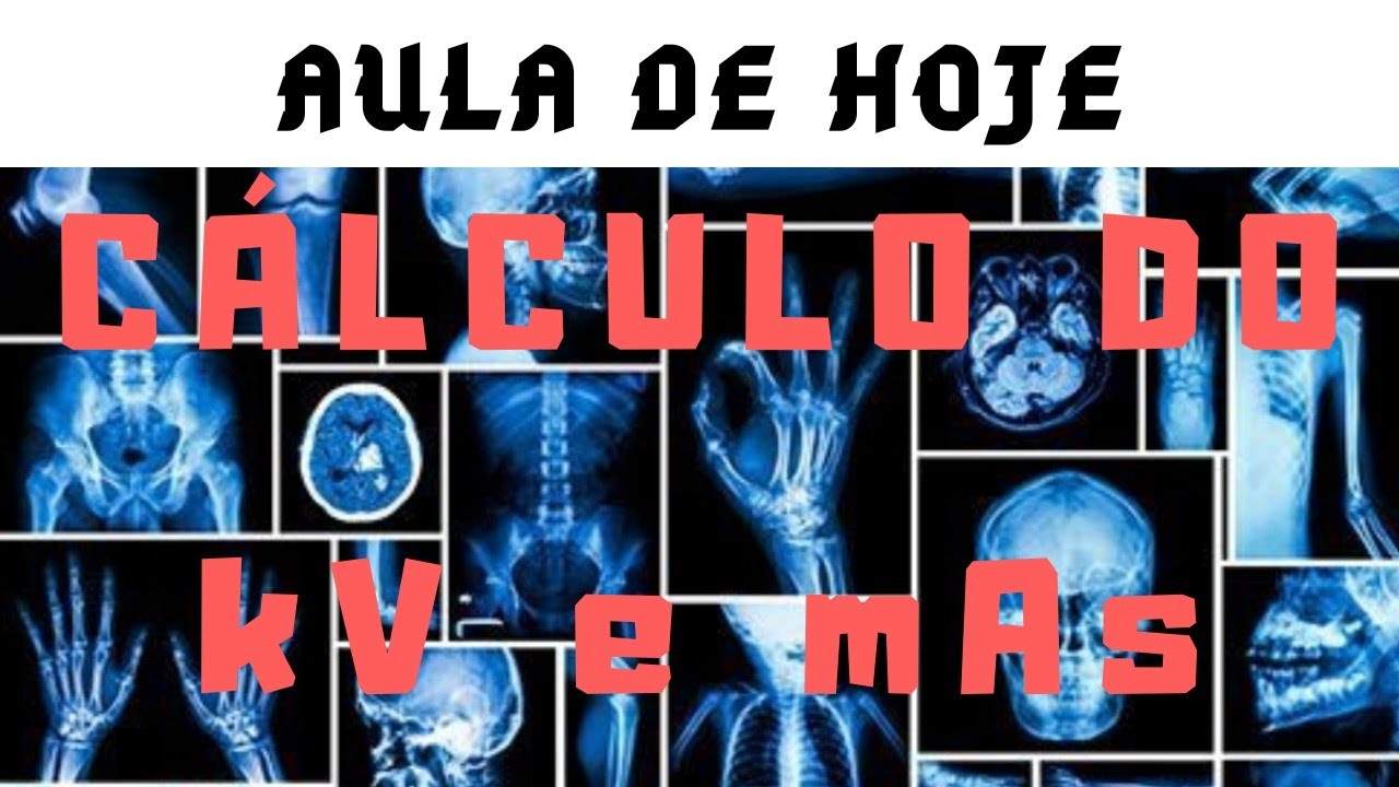 CÁLCULO DO kV e mAs