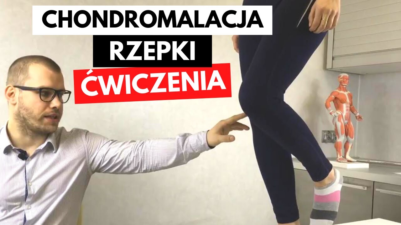 CHONDROMALACJA RZEPKI (uszkodzenie chrząstki stawowej) - TOP 3 Ćwiczenia