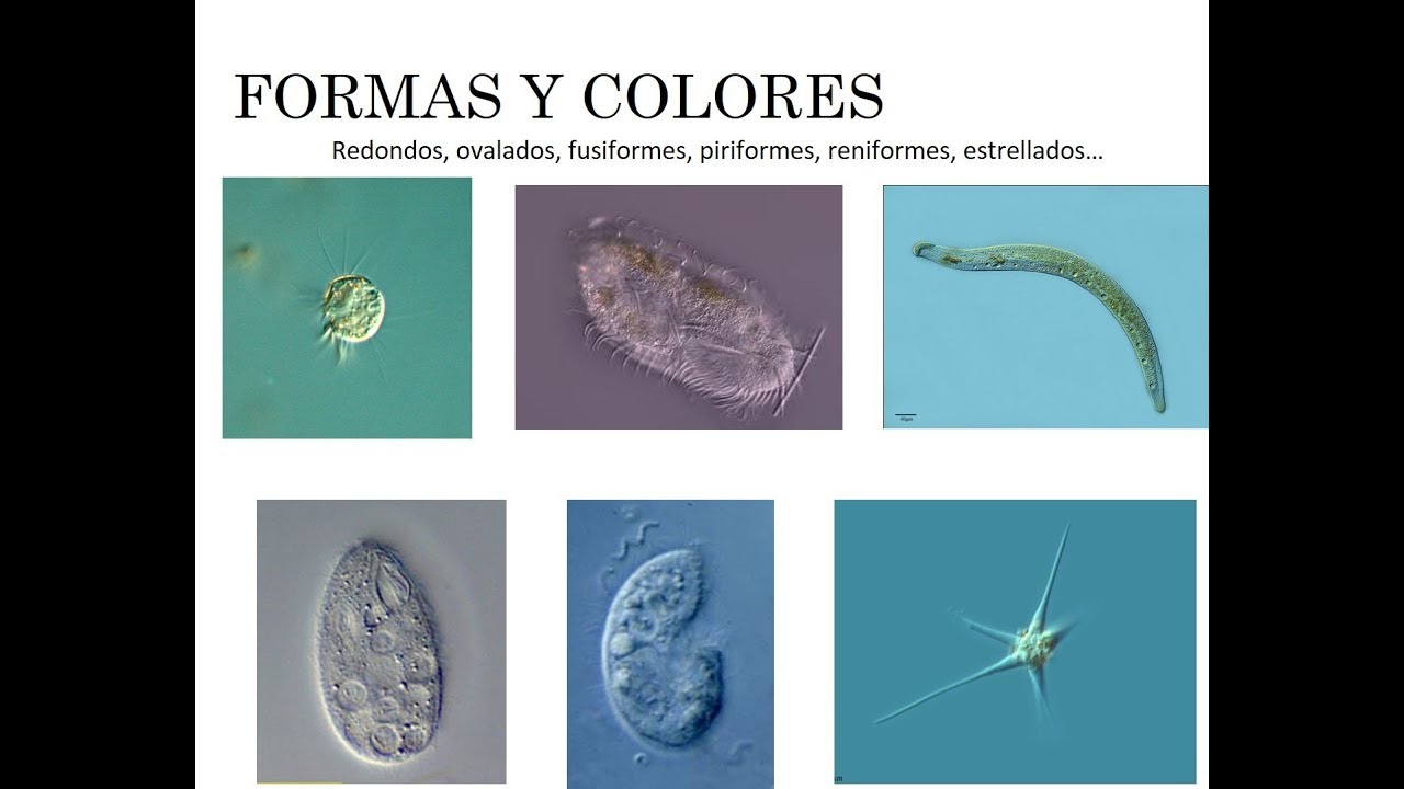 Clase Caracterización de protozoos