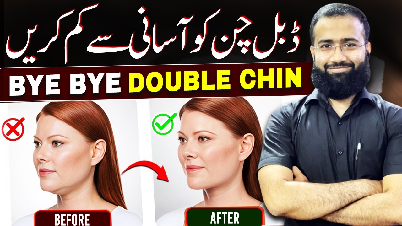 Get Rid Of Double Chin in 5 Minutes | Fix Double Chin Fat