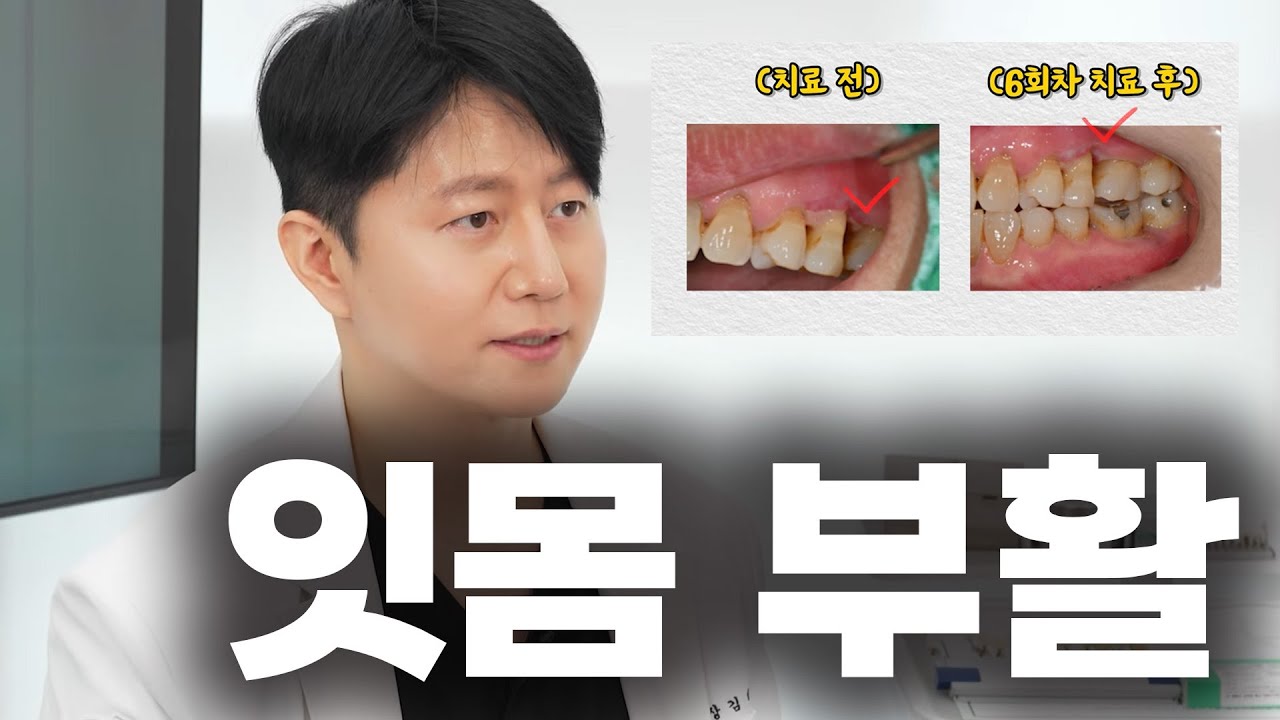 치아 함부로 뽑지 마세요 제발 (엠도게인)