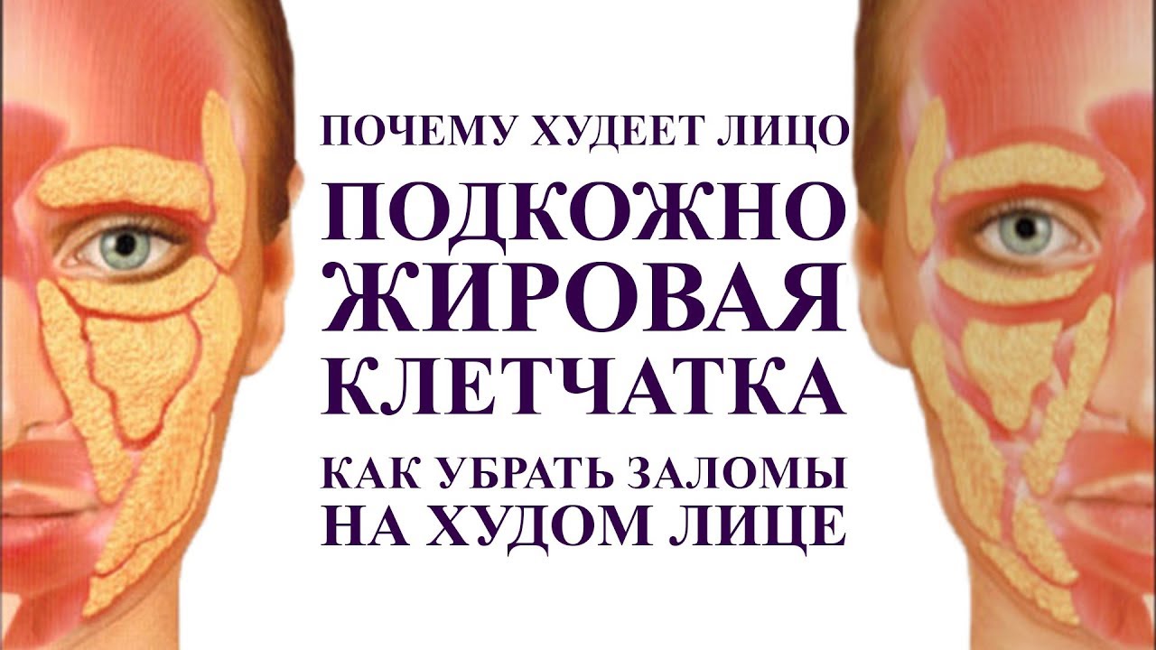 подкожно жировая клетчатка - вся правда. Как убрать заломы на худом лице. Массаж для молодости лица.