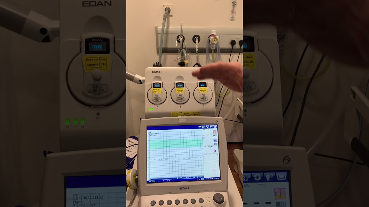 EDAN FTS-3 Telemetry Training Video