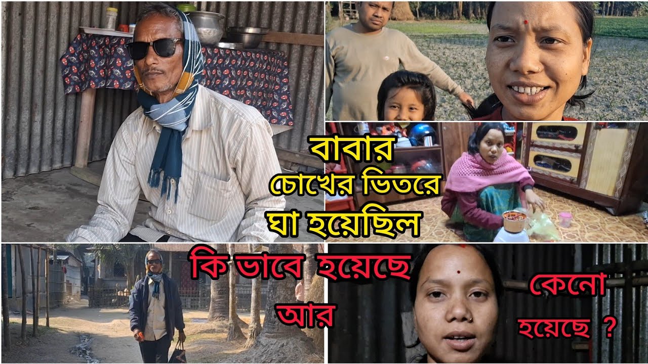 আমার বাবার চোখের ভিতরে ঘা হয়েছিল | কি ভাবে হয়েছে, আর কি কারণে হল আজ তোমাদের শেয়ার করলাম ?
