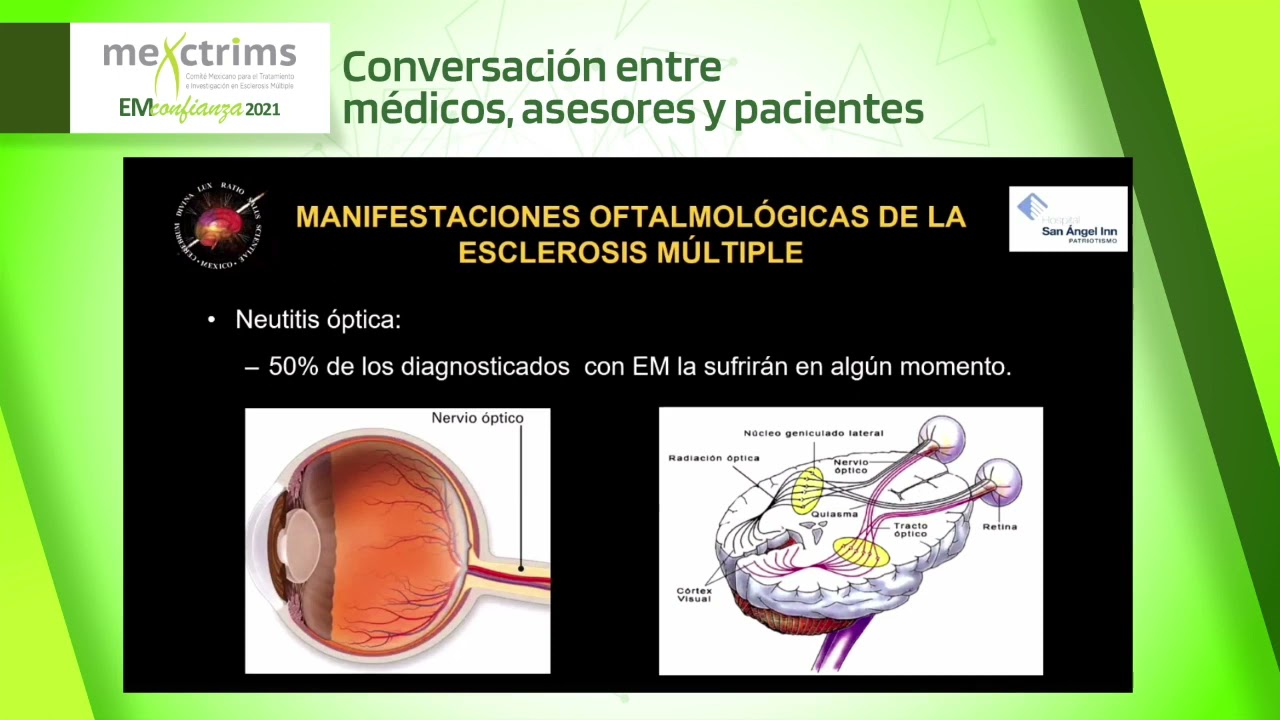 EM Confianza 2021 - Manifestaciones Oftalmológicas de la Esclerosis Múltiple