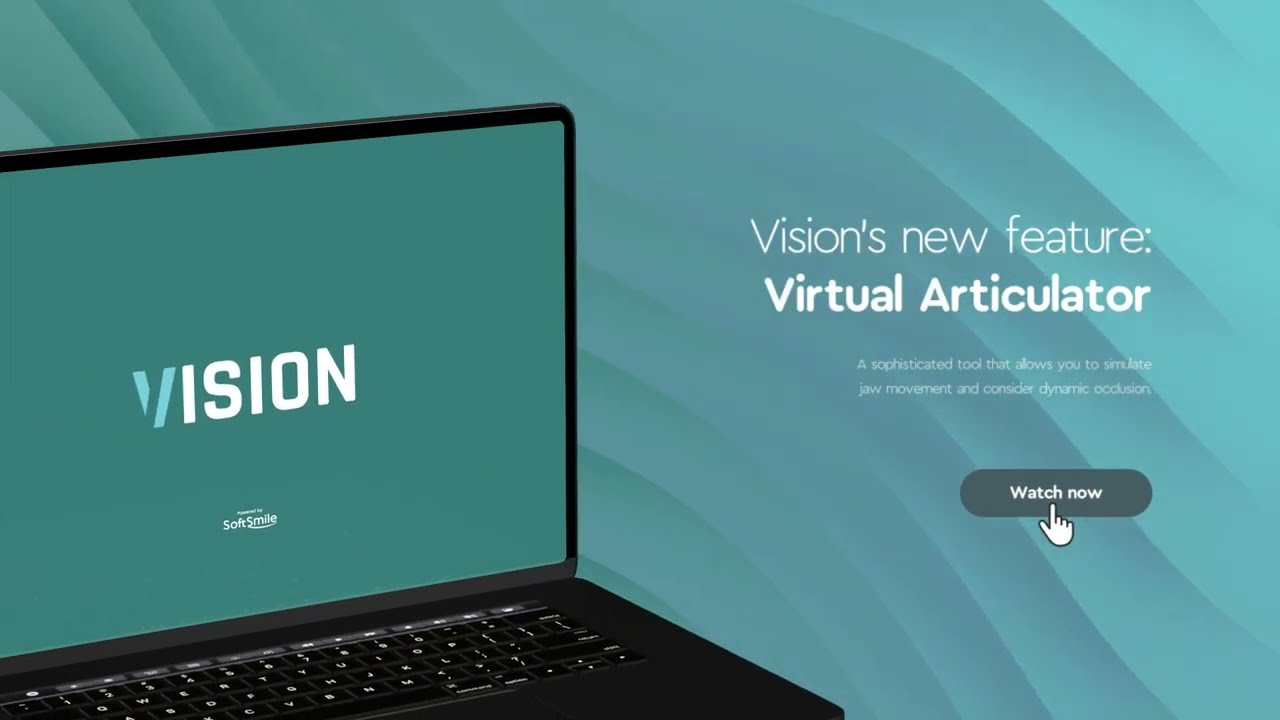 Updated Virtual Articulator for Digital Dental Treatment Planning