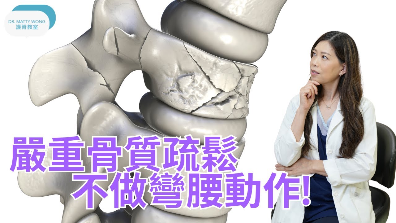 骨質疏鬆不做彎腰動作I示範什麼運動可以做-脊醫王鳳恩(中/Eng Sub)Osteoporosis no bending exercises instead doing this-Dr Wong DC