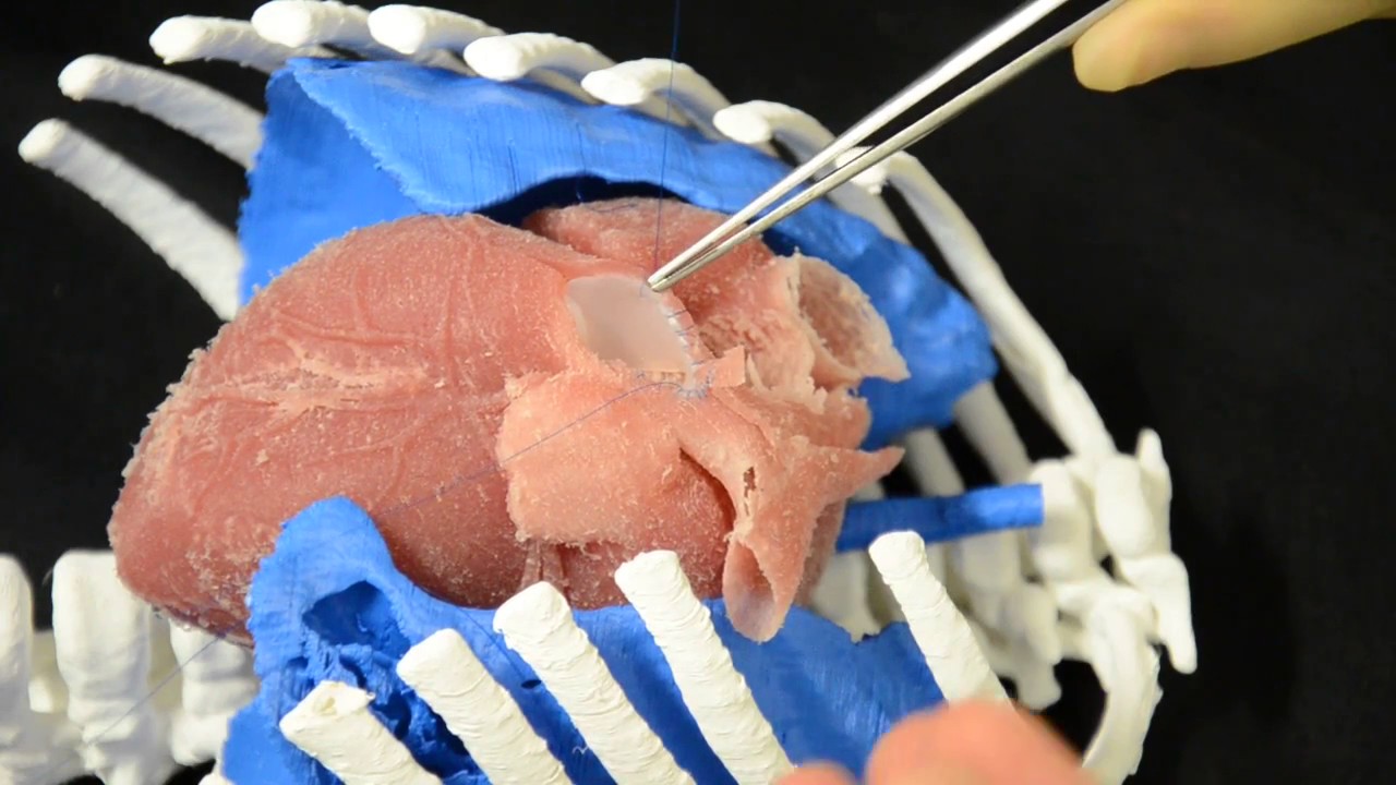 Transannular patch of the pulmonary artery simulation on a 3D printed silicon model