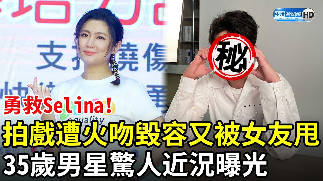勇救Selina！拍戲遭火吻毀容又被女友甩　35歲男星驚人近況曝光 @chinatimesent