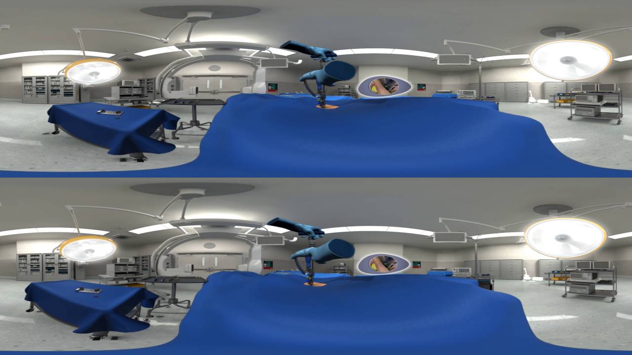 InterBRIDGE – 360° 3D Implantation animation