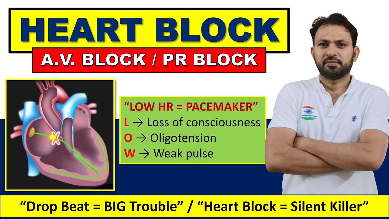 Heart Block (AV Block) Explained | Types, ECG, Causes & Treatment | MediNext Live